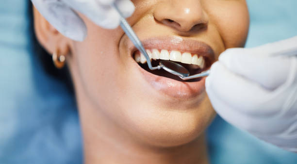 Best Emergency Dental Care for Broken or Chipped Teeth in Antwerp, OH