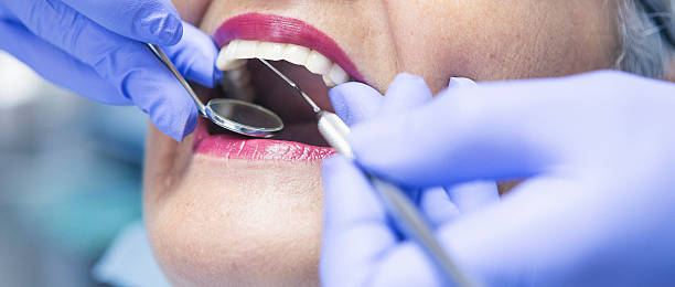 Best Emergency Treatment for Dental Infections or Abscesses in Antwerp, OH